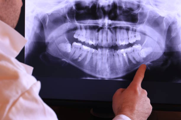 Best Emergency Dental Care for Abscessed Tooth in Broadway, VA