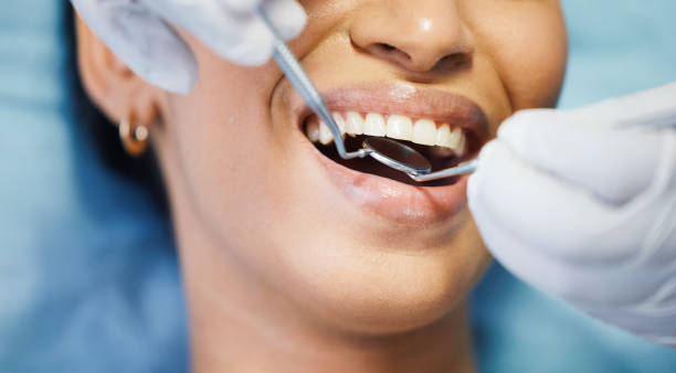 Best Emergency Dental Extractions in Broadway, VA